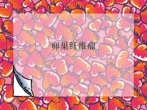 卵巢纤维瘤课件