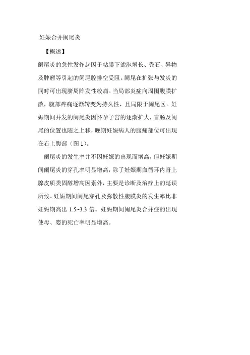 妊娠合并阑尾炎