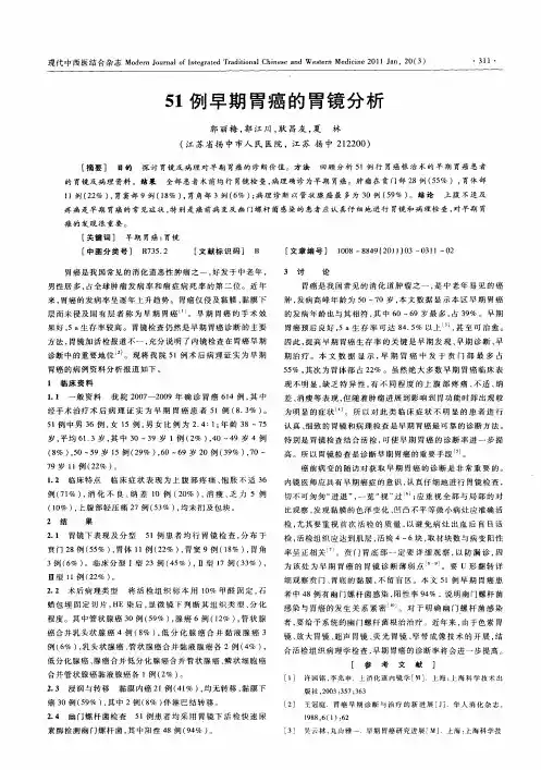 51例早期胃癌的胃镜分析