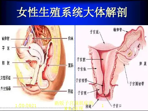 新版子宫腺肌症的MRI表现培训课件