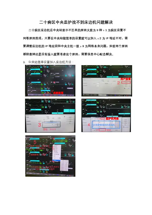 中央监护系统连不到床边监护仪问题解决