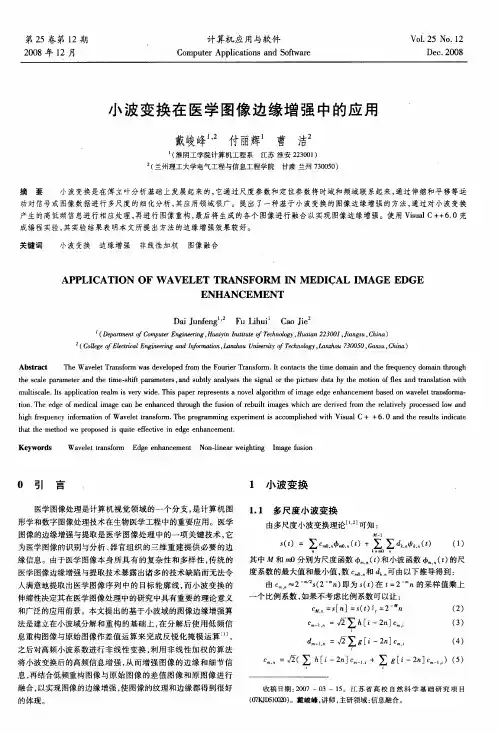 小波变换在医学图像边缘增强中的应用