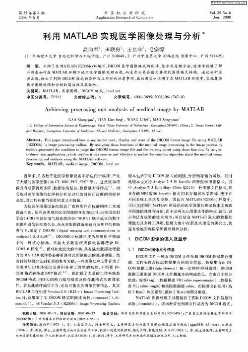 利用MATLAB实现医学图像处理与分析