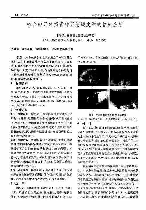 吻合神经的指背神经筋膜皮瓣的临床应用