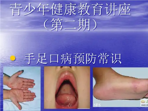 健康教育讲座(第二期)-手足口病 PPT课件