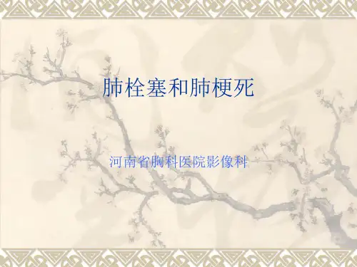 肺栓塞和肺梗死