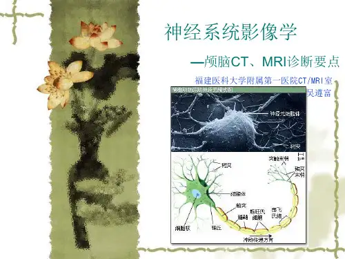 神经系统影像诊断ppt1