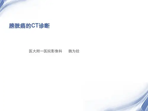 膀胱癌的CT诊断