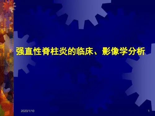强直性脊柱炎的临床、影像学表现