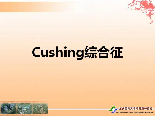 Cushing库欣综合征