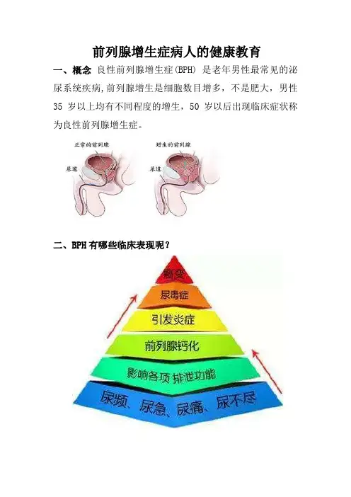 前列腺增生症病人的健康教育(图文)