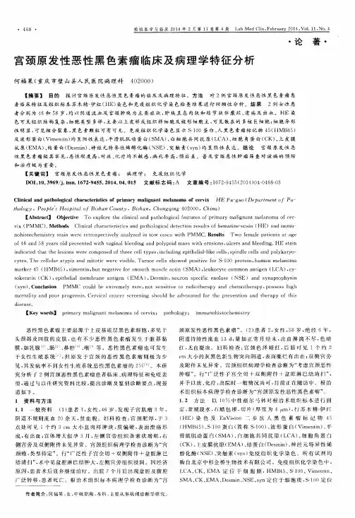 宫颈原发性恶性黑色素瘤临床及病理学特征分析