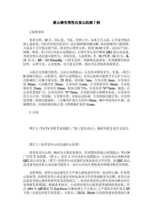 致心律失常性右室心肌病1例