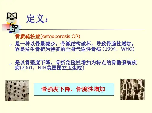 骨质疏松症诊疗指南[文字可编辑]