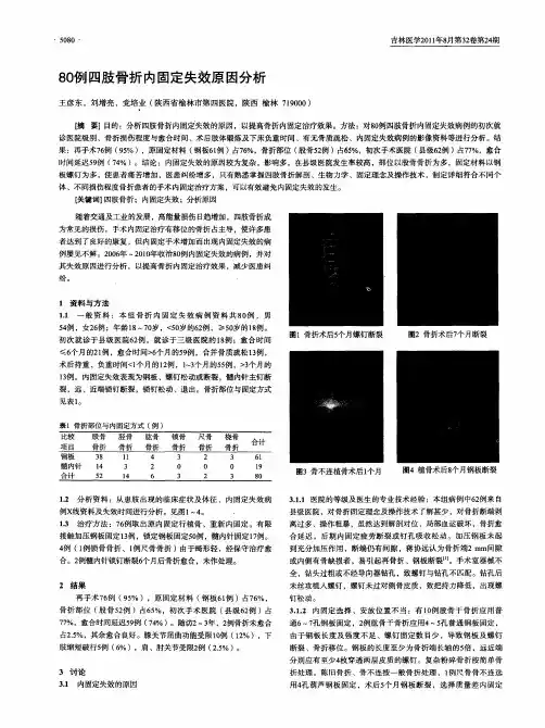 80例四肢骨折内固定失效原因分析