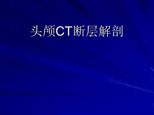 头颅CT断层解剖 PPT课件