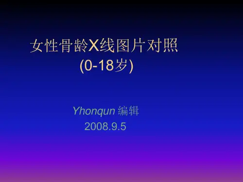 儿童(女性)骨龄X线图片对照PPT课件