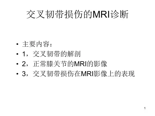 交叉韧带损伤的MRI诊断精品PPT课件