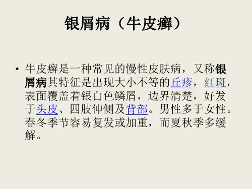 皮肤结构及牛皮癣常识ppt(20)