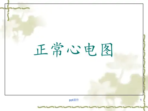 正常心电图及常见异常心电图