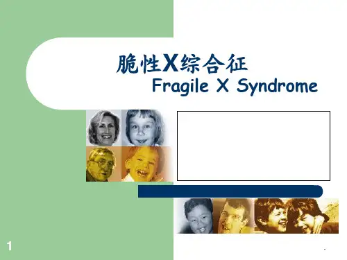 脆性X综合征ppt课件