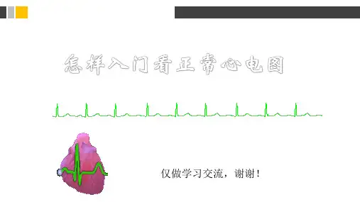 入门看正常心电图培训学习讲解PPT课件
