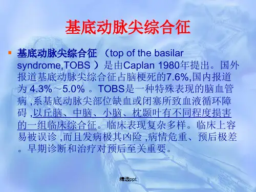 基底动脉尖综合症