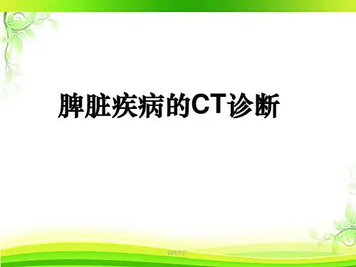 脾脏疾病的CT诊断  ppt课件