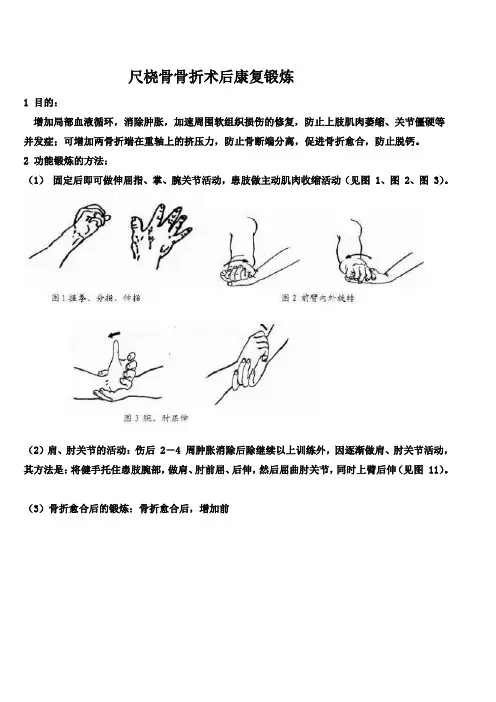尺桡骨骨折功能锻炼