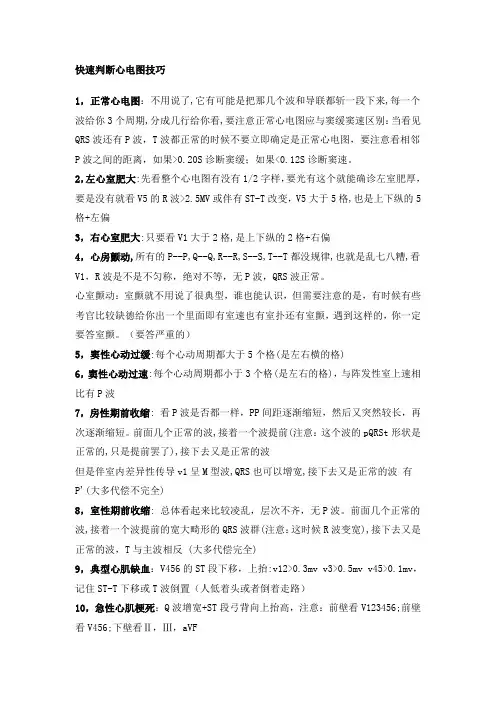 常见心律失常的心电图讲解