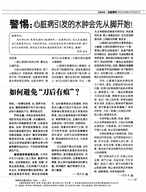 警惕：心脏病引发的水肿会先从脚开始!