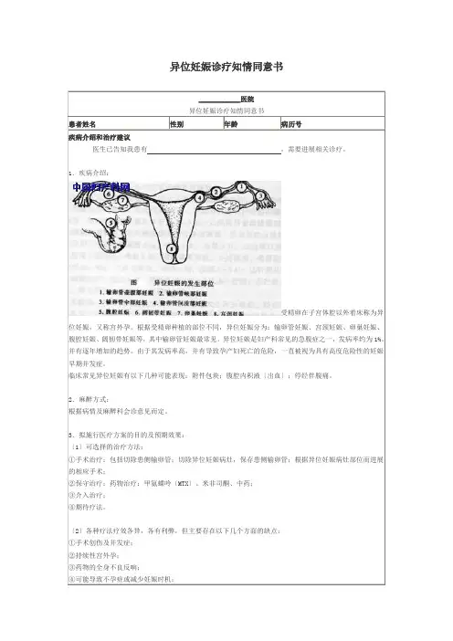 异位妊娠诊疗知情同意书