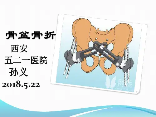 骨盆骨折分型、治疗及康复