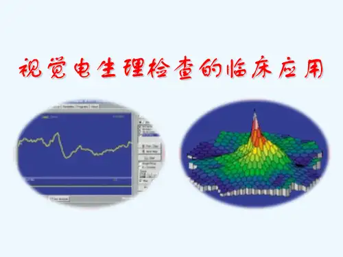 视觉电生理检查的临床应用