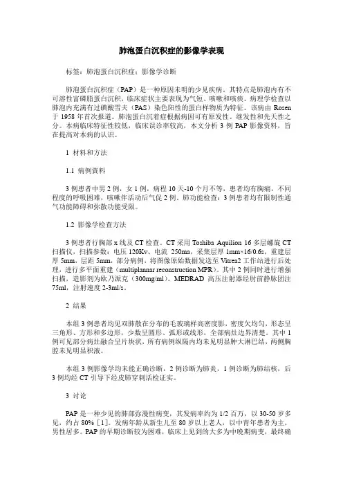 肺泡蛋白沉积症的影像学表现