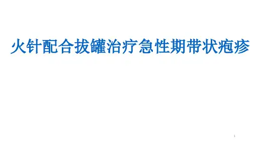 带状疱疹的针灸治疗