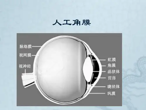 人工眼角膜资料