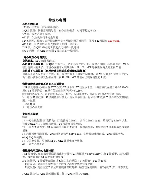 心电图