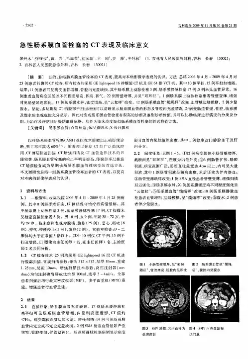 急性肠系膜血管栓塞的CT表现及临床意义