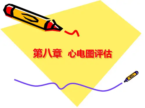 心电图评估