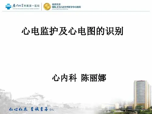心电监护及心电图的识别