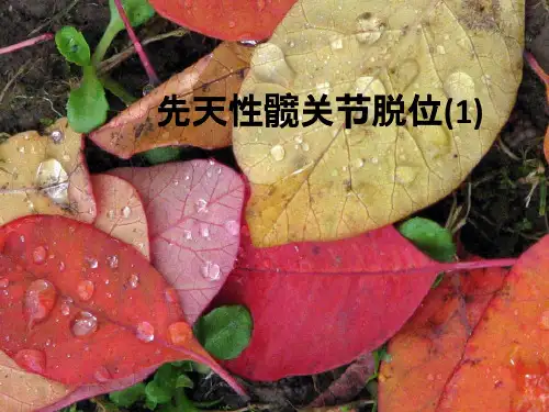 先天性髋关节脱位(1)ppt课件