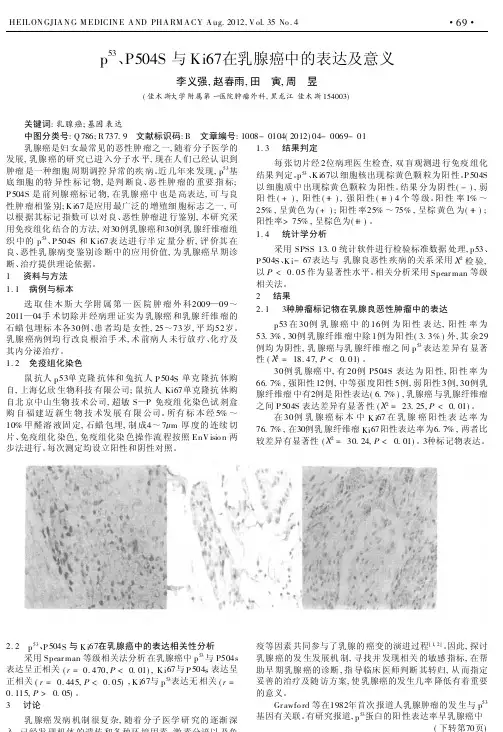 p_53_P504S与Ki67在乳腺癌中的表达及意义