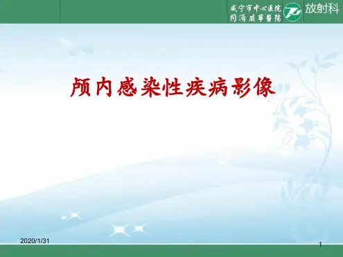 颅内感染性病变的影像诊断
