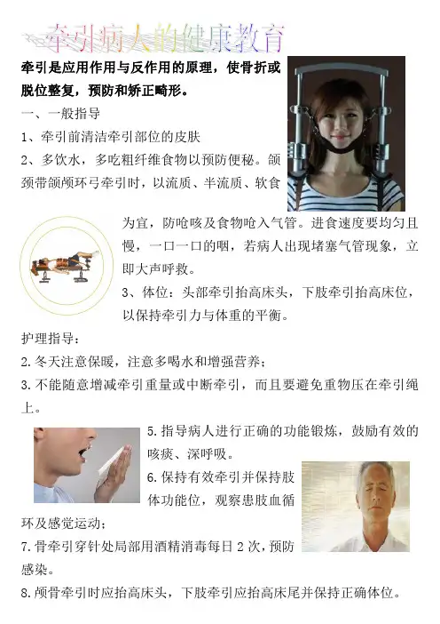 牵引病人的健康宣教