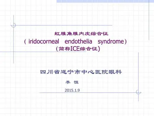 虹膜角膜内皮综合征