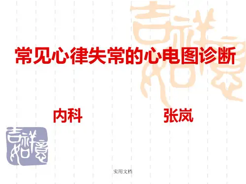 常见心电图诊断最新版本