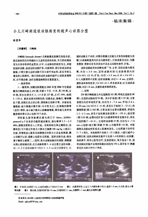 小儿川崎病冠状动脉病变的超声心动图分型