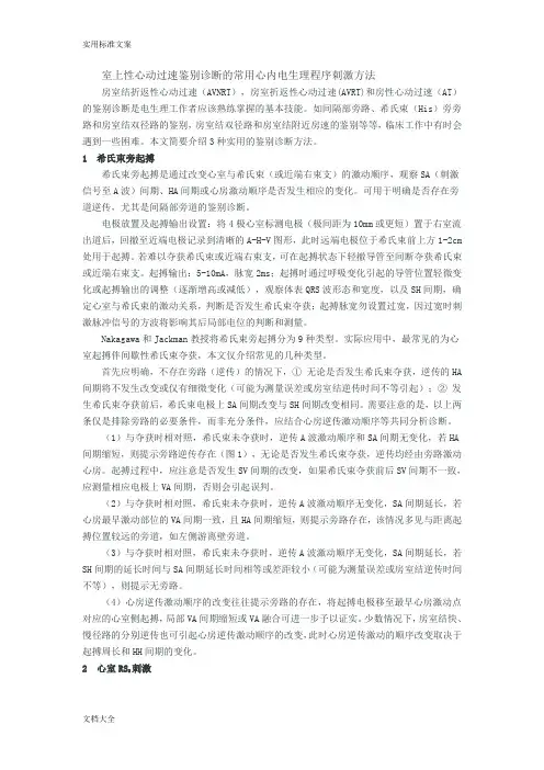 室上性心动过速鉴别诊断地常用心内电生理程序刺激方法