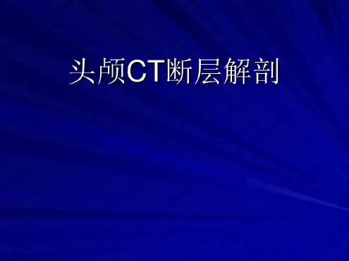 头颅CT断层解剖 (2)
